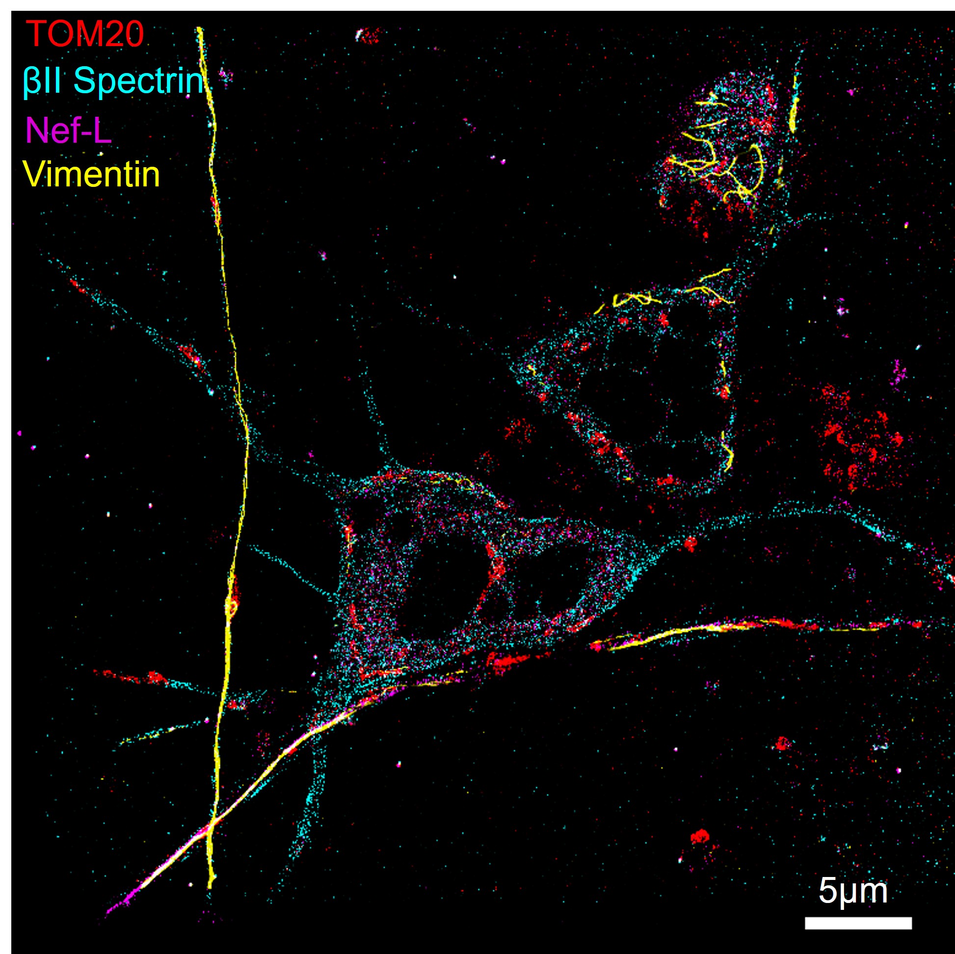 4-color neuronal culture imaging